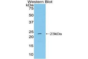 Western Blotting (WB) image for anti-Non Metastatic Cells 6, Protein Expressed In (AA 1-184) antibody (ABIN1860010) (Non Metastatic Cells 6, Protein Expressed In (AA 1-184) Antikörper)