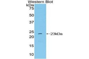 Western Blotting (WB) image for anti-NME/NM23 Nucleoside Diphosphate Kinase 6 (NME6) (AA 1-184) antibody (ABIN1860010) (NME6 Antikörper  (AA 1-184))
