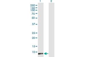 Western Blot analysis of TIMM8B expression in transfected 293T cell line by TIMM8B monoclonal antibody (M15), clone 8E5.