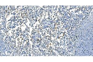 IHC analysis of Carbonic Anhydrase I/CA1 using anti-Carbonic Anhydrase I/CA1 antibody (ABIN7602620).