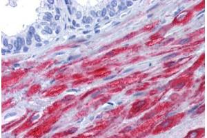 Human Prostate: Formalin-Fixed, Paraffin-Embedded (FFPE) (Smoothelin Antikörper)