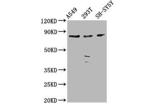 ZC3H14 Antikörper  (AA 176-306)