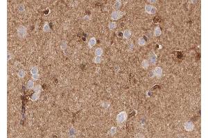 ABIN6268740 at 1/100 staining human brain tissue sections by IHC-P.