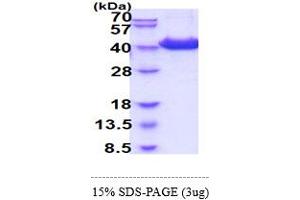 SDS-PAGE (SDS) image for CD81 (CD81) (AA 113-201) protein (hIgG-His-tag) (ABIN5854988) (CD81 Protein (CD81) (AA 113-201) (hIgG-His-tag))