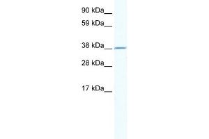 WB Suggested Anti-RNF130 Antibody Titration:  2. (RNF130 Antikörper  (N-Term))