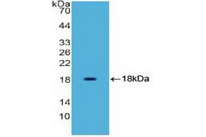 Detection of Recombinant HMGA1, Human using Polyclonal Antibody to High Mobility Group AT Hook Protein 1 (HMGA1) (HMGA1 Antikörper)