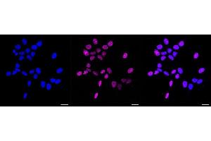 Immunocytochemical staining of HAP-1 cells with Phospho-Rad17 (S656) antibody (ABIN7800113), 1:1,000).
