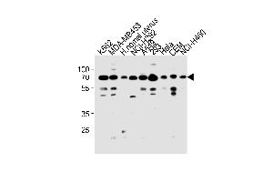 RP3 Antibody (N-term) (ABIN1881632 and ABIN2843271) western blot analysis in K562,MDA-M,NCI-,A549,293,Hela,CEM,NCI- cell line and human nomal uterus tissue lysates (35 μg/lane). (PARP3 Antikörper  (N-Term))