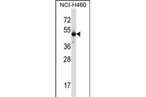 MKX Antibody (N-term) (ABIN657729 and ABIN2846714) western blot analysis in NCI- cell line lysates (35 μg/lane). (MKX Antikörper  (N-Term))