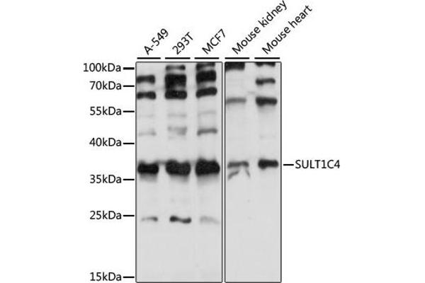 SULT1C4 Antikörper  (AA 1-95)