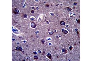 Immunohistochemistry (IHC) image for anti-Amyloid beta (A4) Precursor Protein (APP) (AA 333-362) antibody (ABIN3029927)