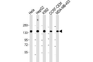 All lanes : Anti-C3 Antibody (C-term) at 1:2000 dilution Lane 1: Hela whole cell lysate Lane 2: HepG2 whole cell lysate Lane 3: K562 whole cell lysate Lane 4: CCRF-CEM whole cell lysate Lane 5: MDA-MB-453 whole cell lysate Lysates/proteins at 20 μg per lane. (C3 Antikörper  (AA 1353-1382))