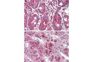 Immunohistochemistry (Formalin/PFA-fixed paraffin-embedded sections) of human small intestine (A) and human adrenal gland (B) tissue with GLP2R polyclonal antibody . (GLP2R Antikörper  (C-Term))