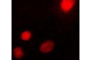 Immunofluorescent analysis of USF1 staining in Hela cells. (USF1 Antikörper)