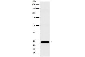 Western blot analysis of Rab25 expression in MCF7 cell lysate.