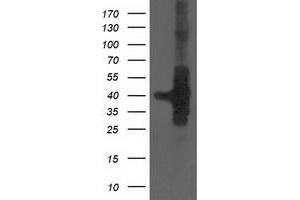 Western Blotting (WB) image for anti-HSPA Binding Protein, Cytoplasmic Cochaperone 1 (HSPBP1) antibody (ABIN1498759) (HSPBP1 Antikörper)