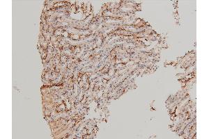 Immunohistochemistry (IHC) image for anti-LIM Domain Kinase 1 (LIMK1) (pThr508) antibody (ABIN6255701)
