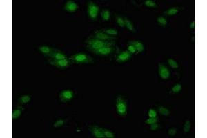 Immunofluorescent analysis of Hela cells using ABIN7151635 at dilution of 1:100 and Alexa Fluor 488-congugated AffiniPure Goat Anti-Rabbit IgG(H+L) (Nth Endonuclease III-Like 1 (NTHL1) (AA 31-312) Antikörper)