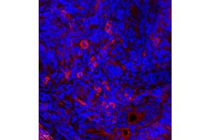 Immunofluorescence (Paraffin-embedded Sections) (IF (p)) image for anti-Myosin Light Chain 6, Alkali, Smooth Muscle and Non Muscle (MYL6) antibody (ABIN7074734)