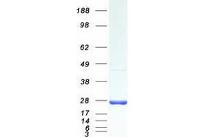Western Blotting (WB) image for RAB1A, Member RAS Oncogene Family (RAB1A) (Transcript Variant 1) protein (Myc-DYKDDDDK Tag) (ABIN2730282)