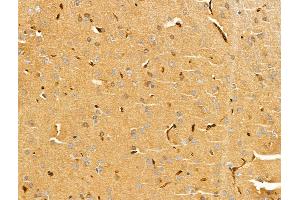 ABIN6261995 and ABIN6269008 at 1/100 staining Rat brain tissue by IHC-P.