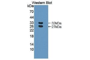 Western Blotting (WB) image for anti-Basal Cell Adhesion Molecule (Lutheran Blood Group) (BCAM) (AA 32-257) antibody (ABIN1866870) (BCAM Antikörper  (AA 32-257))