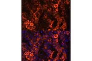 Immunofluorescence analysis of human liver cancer cells using BHMT antibody (ABIN3021749, ABIN3021750, ABIN3021751 and ABIN6215748) at dilution of 1:100. (BHMT Antikörper  (AA 177-406))