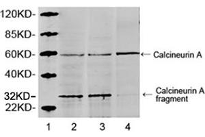 Lane 1: MarkerLane 2: Hela cell lysateLane 3: HEK293 cell lysateLane 4: NIH/3T3 cell lysateWestern blot analysis of cell lysates using 1 µg/mL Rabbit Anti-Calcineurin A Polyclonal Antibody (ABIN398733) The signal was developed with IRDyeTM 800 Conjugated Goat Anti-Rabbit IgG. (Calcineurin A Antikörper  (AA 450-500))