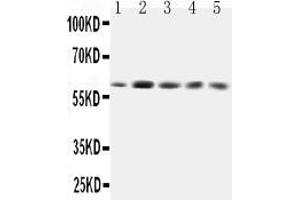 Anti-GRB7 antibody, All Western blottingAll lanes: Anti-GRB7 at 0. (GRB7 Antikörper  (Middle Region))