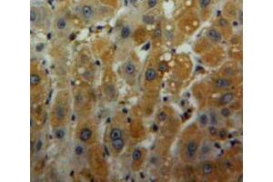 Used in DAB staining on fromalin fixed paraffin-embedded liver tissue (Peroxiredoxin 6 Antikörper  (AA 1-224))