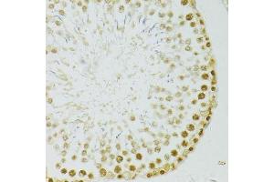 Immunohistochemistry of paraffin-embedded rat testis using ADAR antibody. (ADAR Antikörper  (AA 150-250))