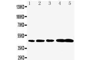 Anti-Caspase-1(P20) antibody,  Western blotting Lane 1: Rat Brain Tissue Lysate Lane 2: Rat Spleen Tissue Lysate Lane 3: Mouse Brain Tissue Lysate Lane 4: Mouse Spleen Tissue Lysate Lane 5: Mouse Testis Tissue Lysate (Caspase 1 Antikörper  (N-Term))
