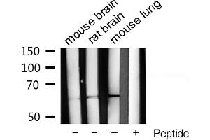 Western blot analysis of extracts of various celllines,using Phospho-Src (Tyr529) Antibody . (Src Antikörper  (pTyr530))