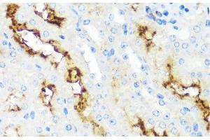 Immunohistochemistry of paraffin-embedded Mouse kidney using MME Polyclonal Antibody at dilution of 1:100 (40x lens). (MME Antikörper)