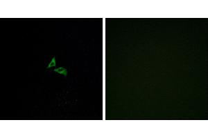Peptide - +Western blot analysis of extracts from Jurkat cells, using EDG7 antibody. (LPAR3 Antikörper  (C-Term))