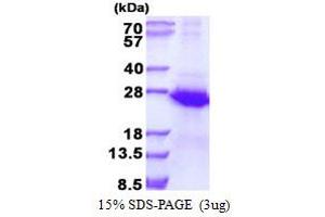 ECSIT (ECSIT) (AA 19-217) protein (His tag)