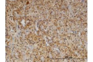Image no. 1 for anti-Cerebellar Degeneration-Related Protein 2, 62kDa (CDR2) (AA 296-405) antibody (ABIN599360) (CDR2 Antikörper  (AA 296-405))