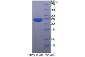 SDS-PAGE (SDS) image for Stromal Cell Derived Factor 4 (SDF4) (AA 184-382) protein (His tag) (ABIN1879421) (SDF4 Protein (AA 184-382) (His tag))