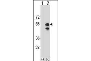 Western blot analysis of CPN1 (arrow) using rabbit polyclonal CPN1 Antibody (N-term) (ABIN391509 and ABIN2841471). (CPN1 Antikörper  (N-Term))