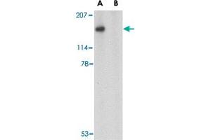 Western blot analysis of SLITRK5 in NIH/3T3 cell lysate with SLITRK5 polyclonal antibody  at 1 ug/mL in the (A) absence or (B) presence of blocking peptide.
