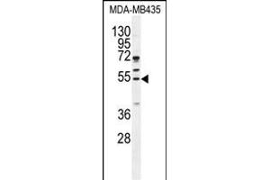 CCNB1 Antibody (Center) (ABIN655048 and ABIN2844676) western blot analysis in MDA-M cell line lysates (35 μg/lane). (Cyclin B1 Antikörper  (AA 241-268))