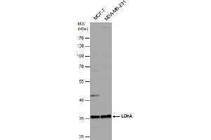 WB Image Various whole cell extracts (30 μg) were separated by 10% SDS-PAGE, and the membrane was blotted with LDHA antibody , diluted at 1:1000. (Lactate Dehydrogenase A Antikörper)