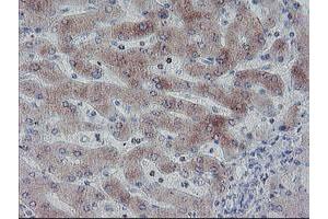 Immunohistochemical staining of paraffin-embedded Human liver tissue using anti-C20orf3 mouse monoclonal antibody. (APMAP Antikörper)
