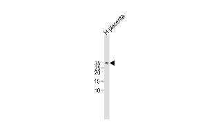 All lanes : Anti-CGB/HCG-Beta Antibody (C-term)at 1:1000 dilution Lane 1:Human placenta lysate Lysates/proteins at 20 μg per lane. (CGB Antikörper  (C-Term))