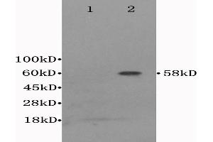 L1 Mouse cerebrum lysates, L2 mouse liver lysates probed with Anti- CD122/IL-2RB Polyclonal Antibody, Unconjugated (ABIN675923) at 1:300 in 4 °C. (IL2 Receptor beta Antikörper  (AA 501-551))