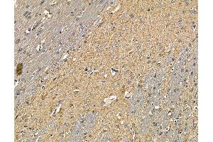 ABIN6264733 and ABIN6279767 at 1/100 staining rat brain tissue by IHC-P. (ARHGAP20 Antikörper  (Internal Region))