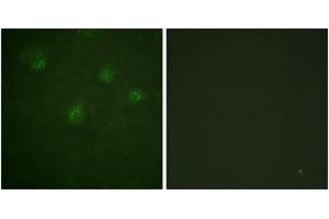 Immunofluorescence analysis of A549 cells, using Estrogen Receptor-alpha (Ab-537) Antibody. (Estrogen Receptor alpha Antikörper  (AA 501-550))