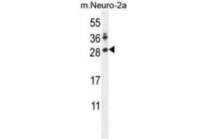 Western Blotting (WB) image for anti-Lin-28 Homolog A (C. Elegans) (LIN28A) antibody (ABIN2996080)