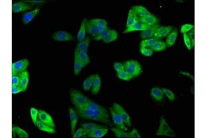 Immunofluorescence staining of HepG2 cells with ABIN7163597 at 1:100, counter-stained with DAPI.