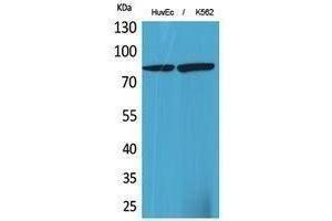 Western Blotting (WB) image for anti-17beta-HSD4 (N-Term) antibody (ABIN3181027) (17beta-HSD4 (N-Term) Antikörper)